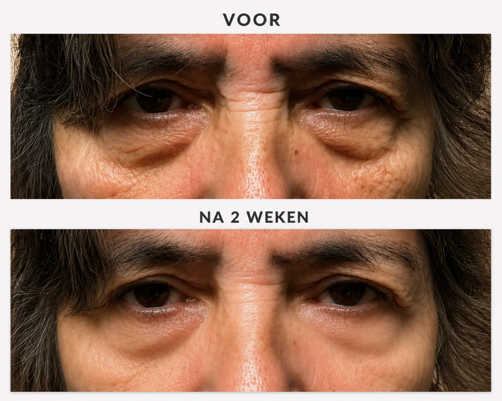 Nouvi LumiEyes™